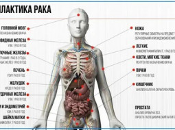 Обнаружен новый способ избежать онкологических заболеваний